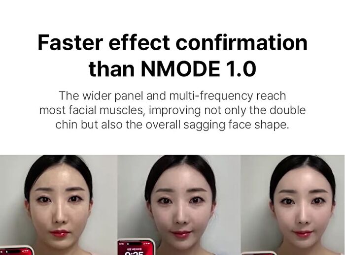 Nmode Pro Pink Edition - 1 set