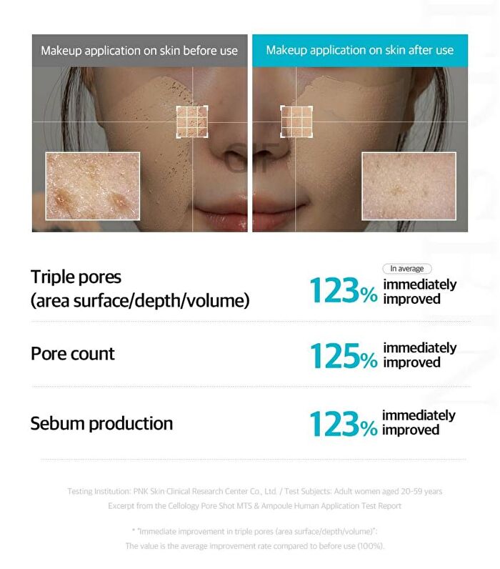 Pore Shot MTS - 1 set