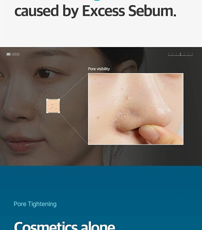 Pore Shot MTS - 1 set
