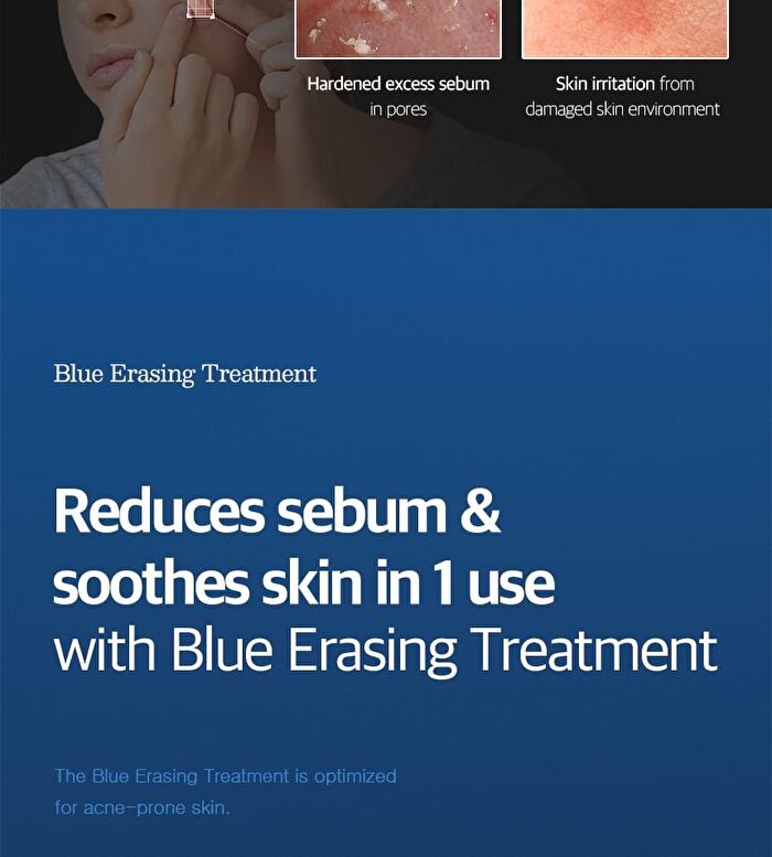 Blue Eraser Serum Refill Only - 15ml