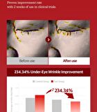Fill Up Eye Serum - 1 set