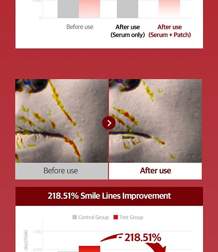 Fill Up Eye Serum - 1 set