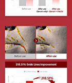 Fill Up Eye Serum - 1 set