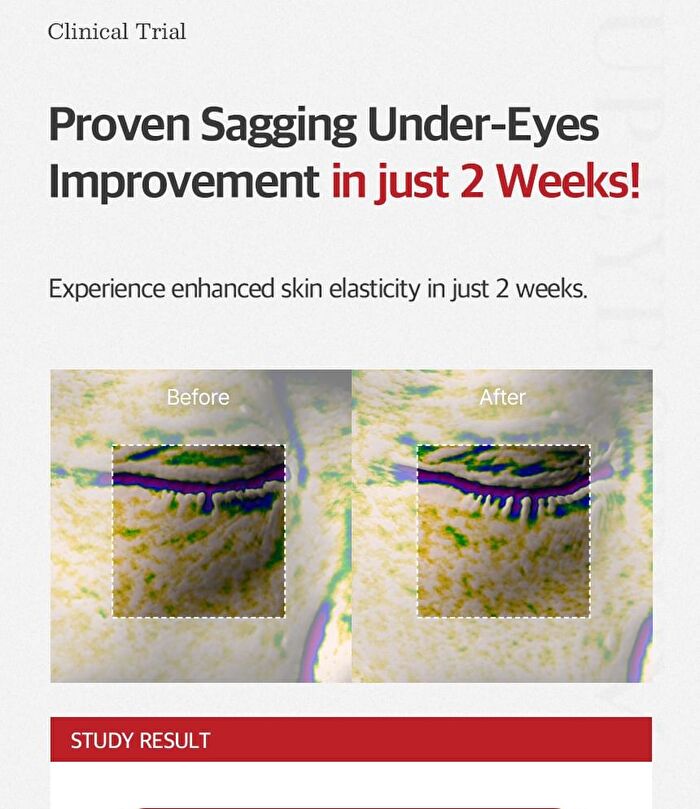 Fill Up Eye Serum - 1 set