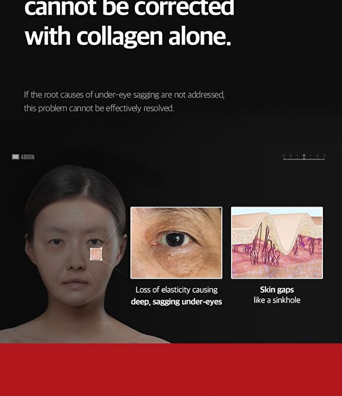Fill Up Eye Serum - 1 set