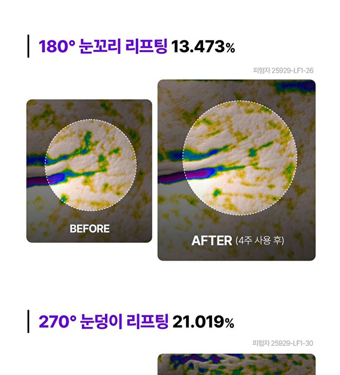 360º Shot PDRN Lifting Eye Cream - 30ml
