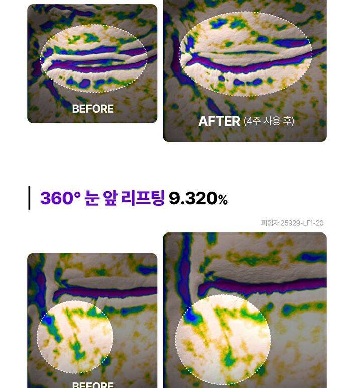 360º Shot PDRN Lifting Eye Cream - 30ml