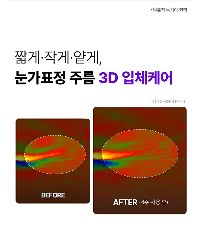 360º Shot PDRN Lifting Eye Cream - 30ml
