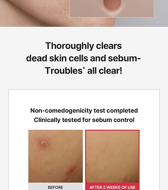 Glycolic Acid X Vitamin C Calming Toner - 180ml
