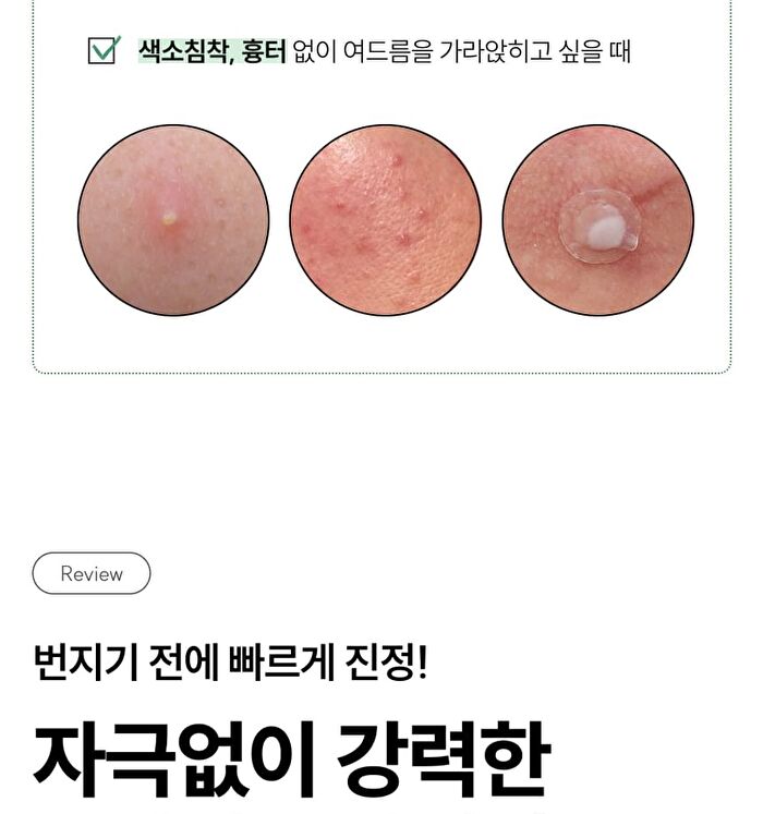 Soothing Pore On Treatment Gel - 10g