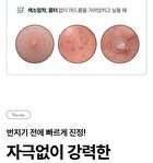Soothing Pore On Treatment Gel - 10g