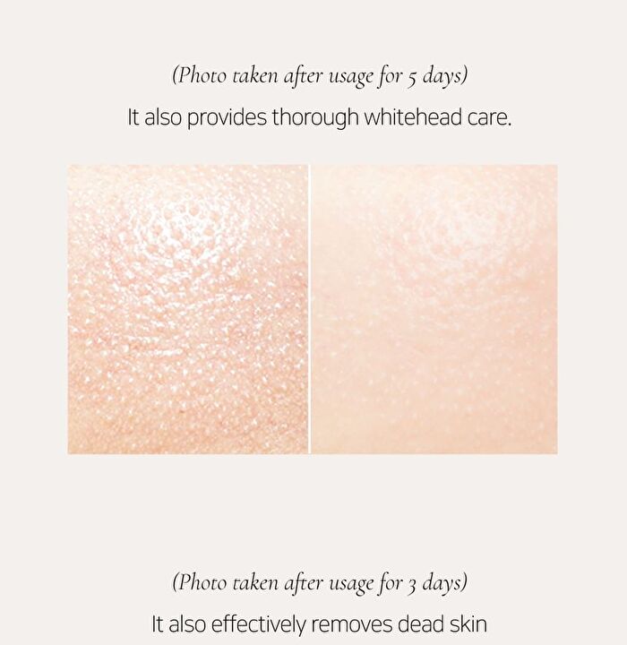 Last Deep Cleansing Balm - 100ml