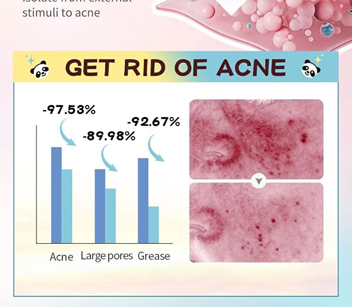 Sadoer Panda Hydrocolloid Acne Patch - 40pcs