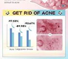 Sadoer Panda Hydrocolloid Acne Patch - 40pcs