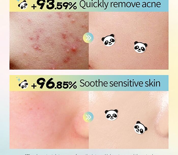 Sadoer Panda Hydrocolloid Acne Patch - 40pcs