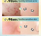 Sadoer Panda Hydrocolloid Acne Patch - 40pcs