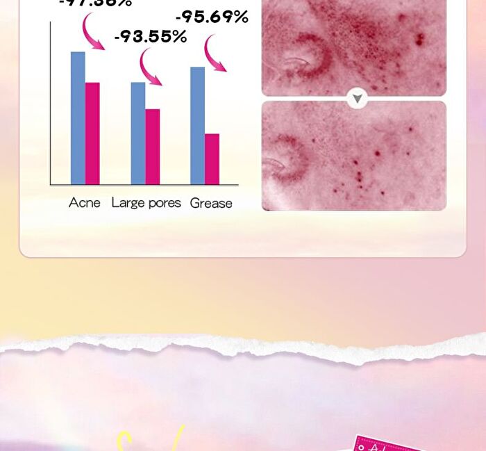 Sadoer Colored Bear Butterfly Star Acne Patch - 48pcs