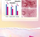 Sadoer Colored Bear Butterfly Star Acne Patch - 48pcs