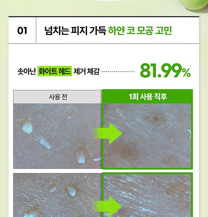Madeca Real Green Pore Nose Pack - 5 sets