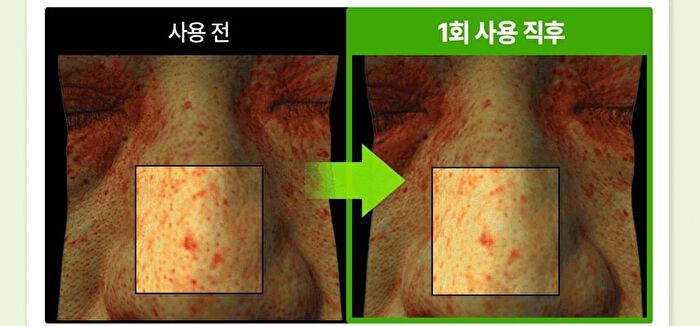 Madeca Real Green Pore Nose Pack - 5 sets