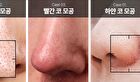 Madeca Real Green Pore Nose Pack - 5 sets