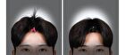 Volume Pincher - 2 Types - L