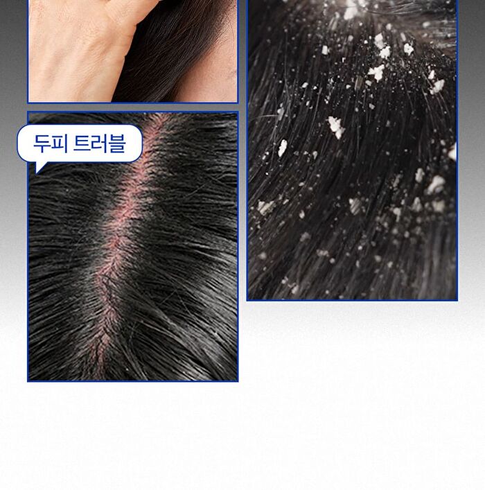 Dandruff Brush - 1 pc