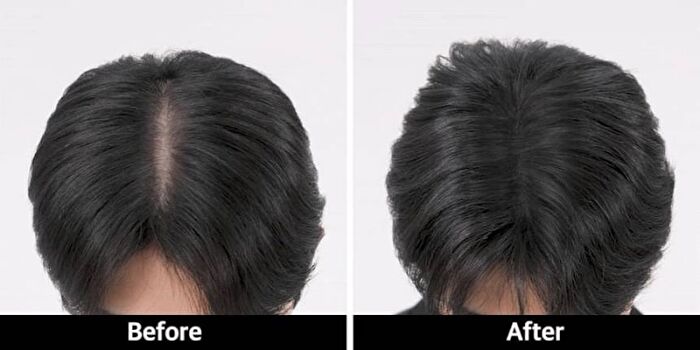 Scalp Tattoo - 2 Colors - #Brown