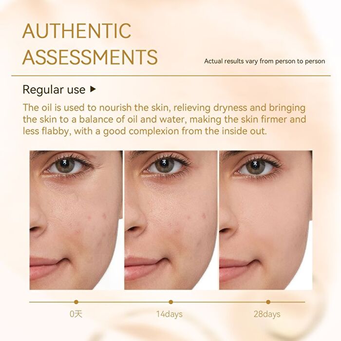 Phoenix Rosehip Anti-Aging Face Oil - 30ml