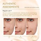 Phoenix Rosehip Anti-Aging Face Oil - 30ml