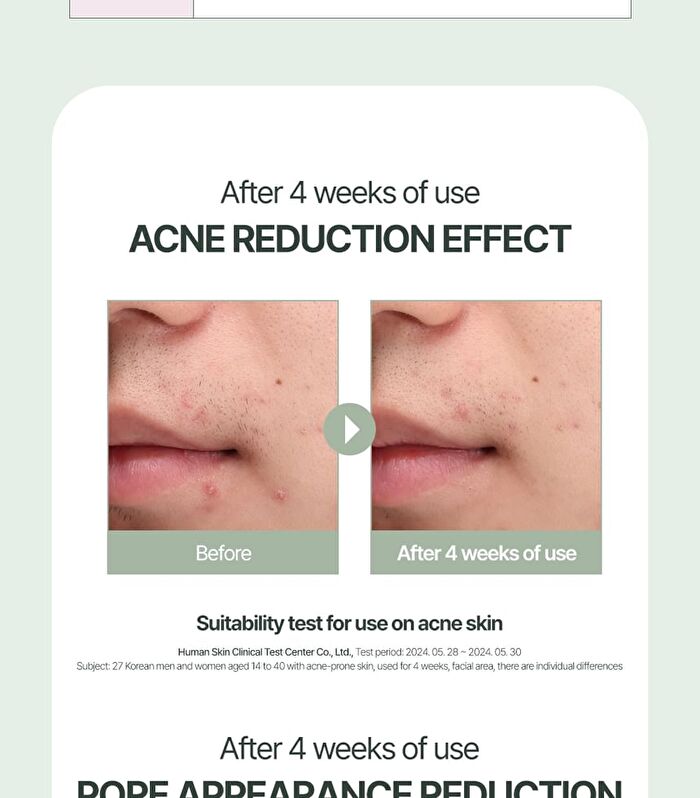 Vita K-Cica AC Clear Treatment Serum - 50ml