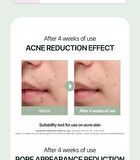 Vita K-Cica AC Clear Treatment Serum - 50ml