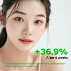 Chungmijung Melasma Blemish Cream Kakadu Plum - 2025 Version - 50g