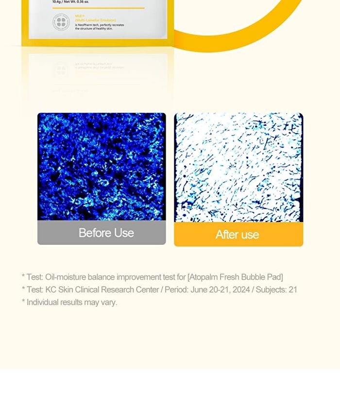 Fresh Bubble Shower Pad Set - 5 pcs