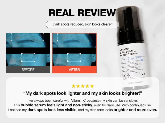 Vitamin Skin Booster Bubble Serum - 100ml
