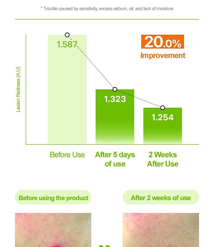 Control-T Tea Tree Capsule Serum - 30ml