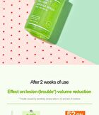 Control-T Tea Tree Capsule Serum - 30ml