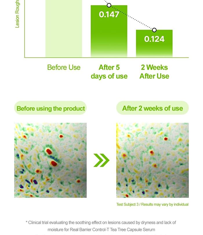Control-T Tea Tree Capsule Serum - 30ml