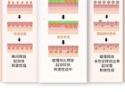2% Salicylic Acid Jelly Mask - 2 Types - 100g