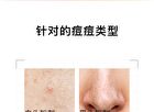 2% Salicylic Acid Jelly Mask - 2 Types - 40g