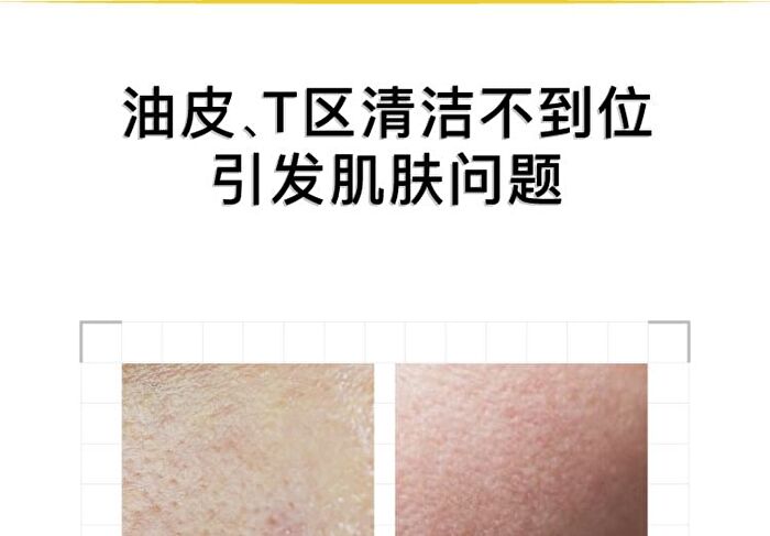 26% Multi-Acid Purifying Clay Mask - 100g