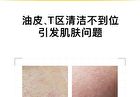 26% Multi-Acid Purifying Clay Mask - 100g