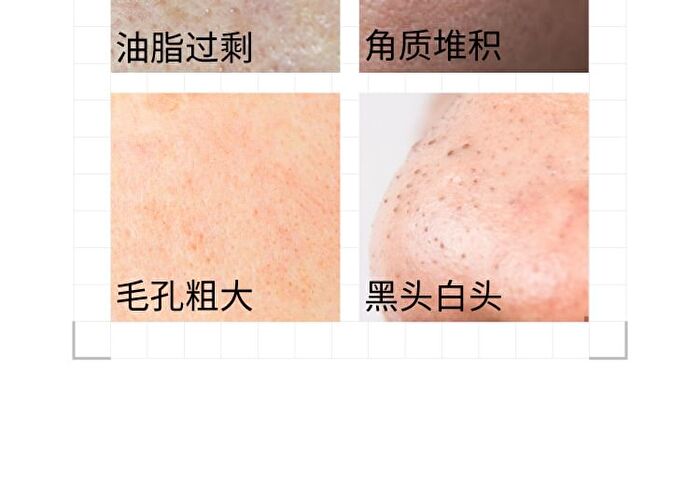 26% Multi-Acid Purifying Clay Mask - 100g