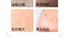 26% Multi-Acid Purifying Clay Mask - 100g