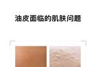 Natural Silica Powder - 3 Colors - 02# Pink - 7g