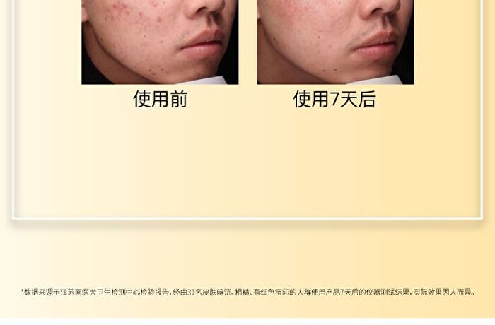 Vitamin C Brightening Sheet Mask - (25g + 1.32g) - 10pcs