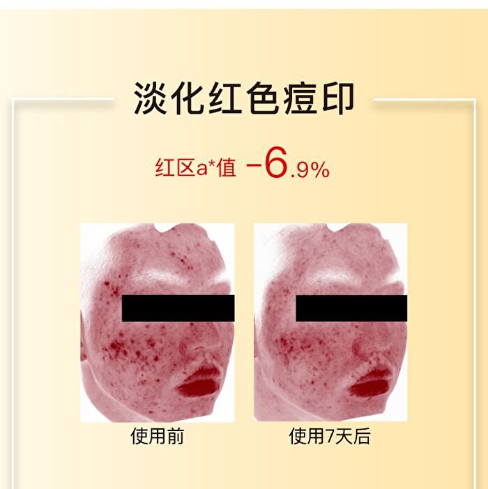 Vitamin C Brightening Sheet Mask - (25g + 1.32g) - 10pcs