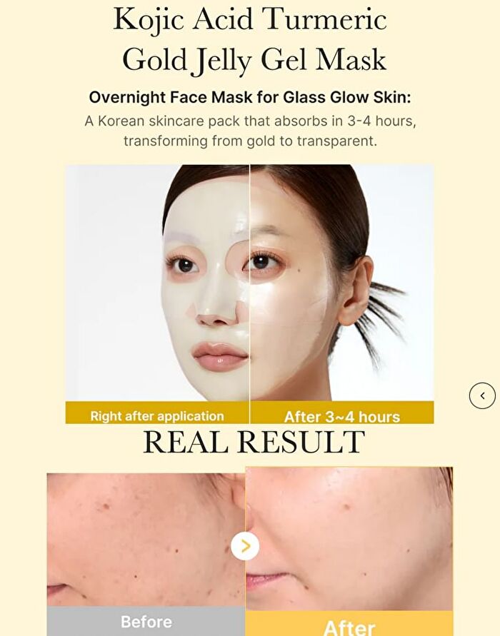 Kojic Acid Turmeric Brightening Gel Mask Set (EU/UK Packaging) - 28g x 4 sheets