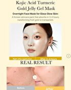 Kojic Acid Turmeric Brightening Gel Mask Set (EU/UK Packaging) - 28g x 4 sheets