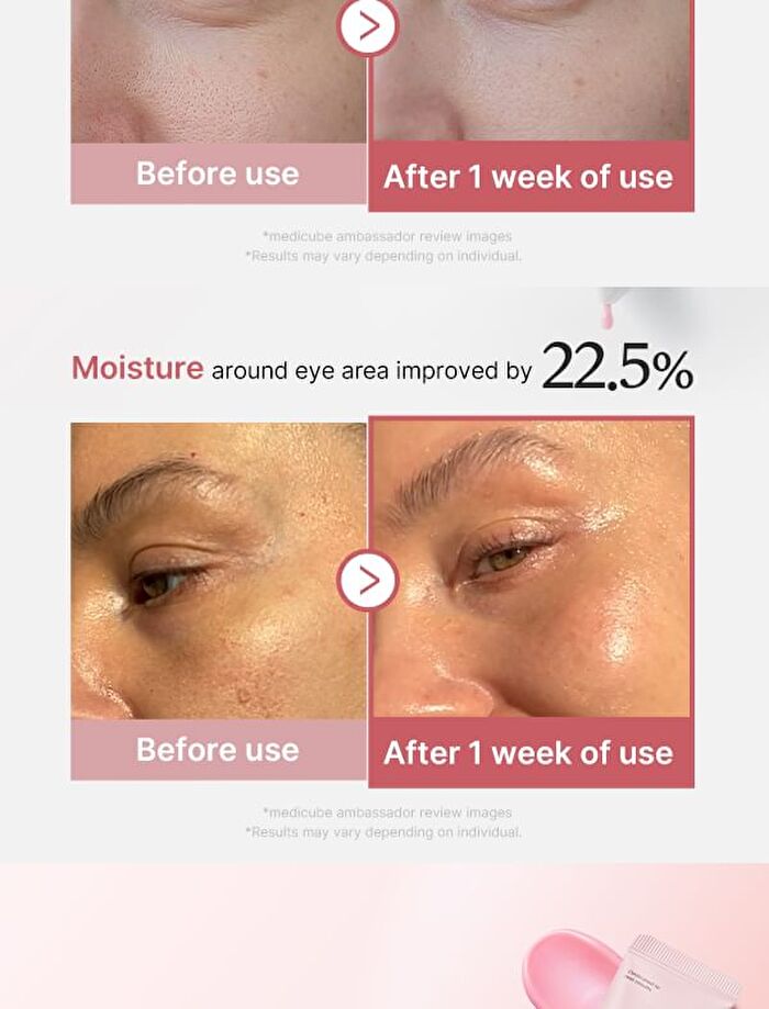 PDRN Pink Peptide Eye Cream (EU/UK Packaging) - 30ml
